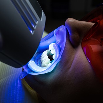 UV light whitening a patient’s teeth in-office